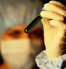 як здавати аналізи на наявність паразитів